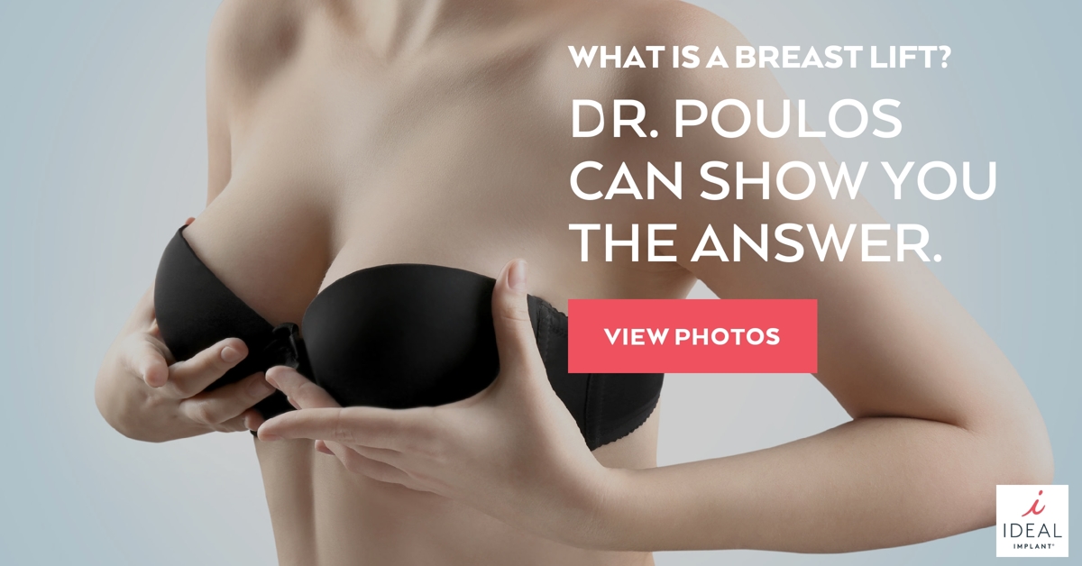 What is a Breast Lift? Dr. Poulos Can Show You