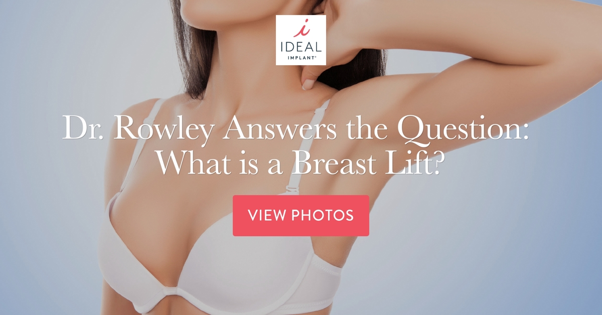 Dr. Rowley Answers the Question, What is a Breast Lift?