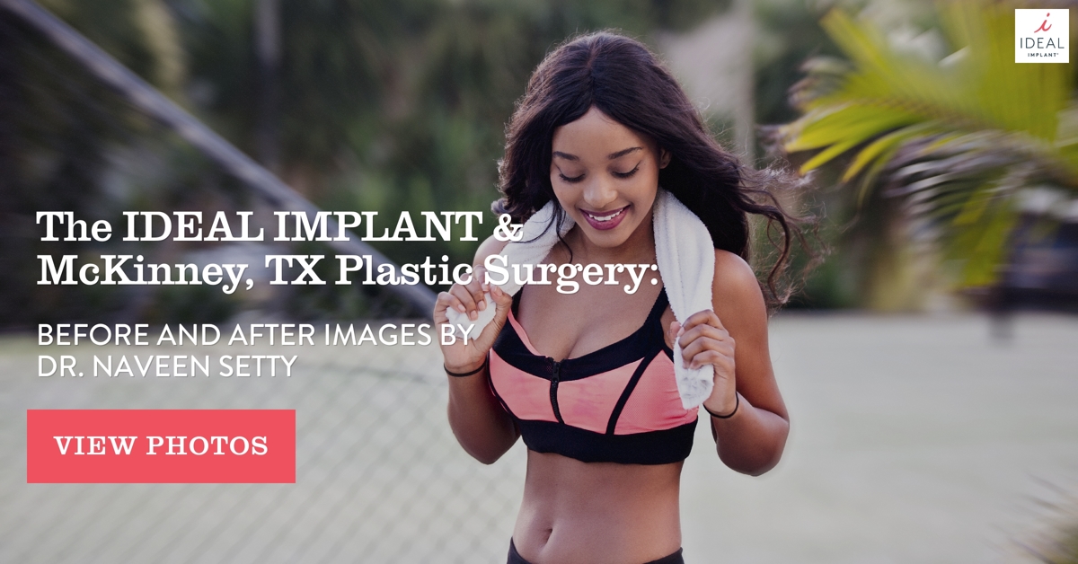 The IDEAL IMPLANT and McKinney, TX Plastic Surgery: Before and After Images by Dr. Naveen Setty