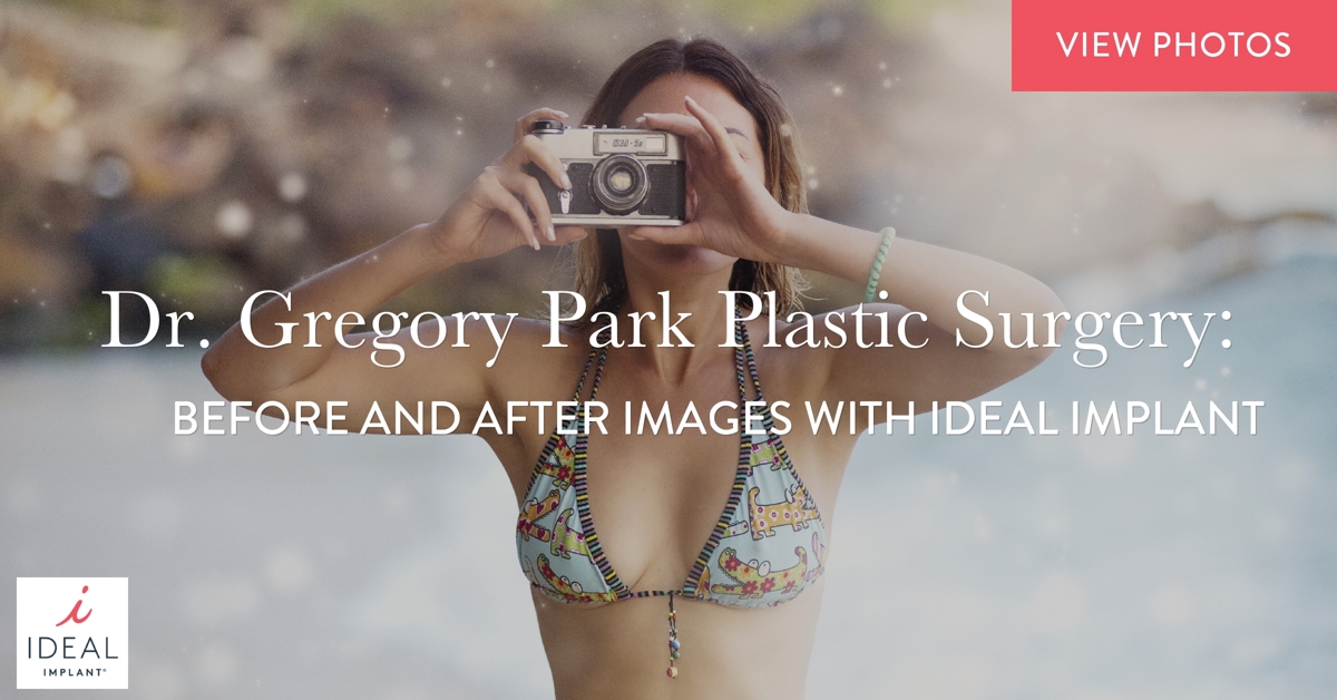 Dr. Gregory Park, Oceanside, CA, Plastic Surgery: Before and After Images with IDEAL IMPLANT