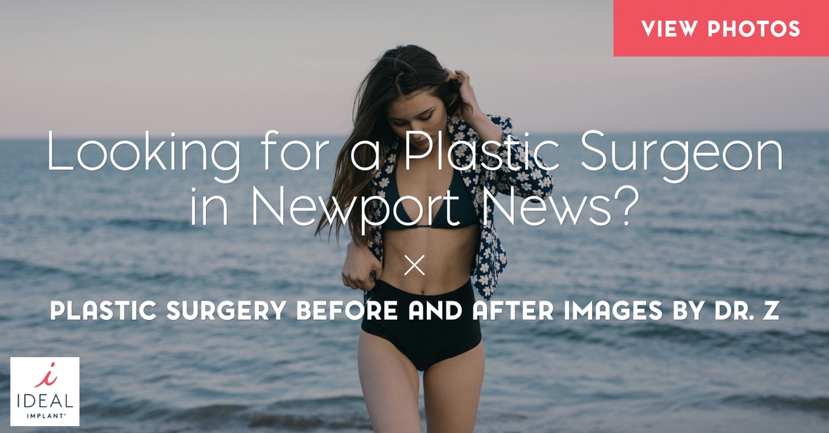 Looking for Breast Implants in Newport News? Before and After Images by Dr. Z