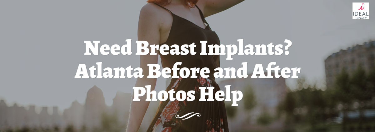 Researching Breast Implants? Atlanta Before and After Photos Help