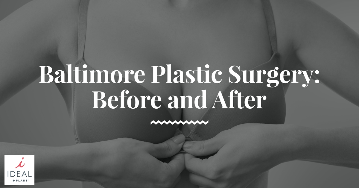 Baltimore Plastic Surgery: Before and After