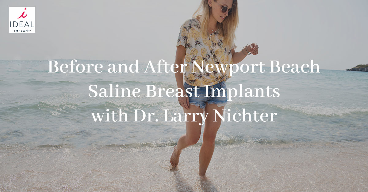 Before and After Newport Beach Saline Breast Implants with Dr. Larry Nichter
