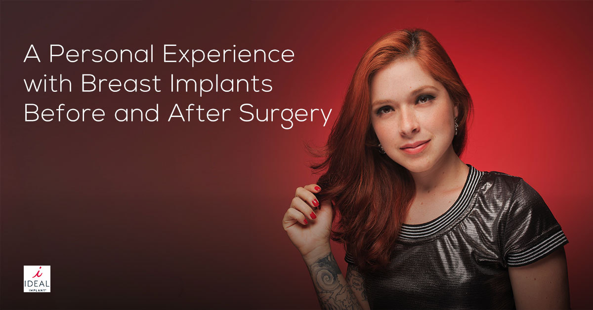 A Personal Experience with Breast Implants Before and After Surgery