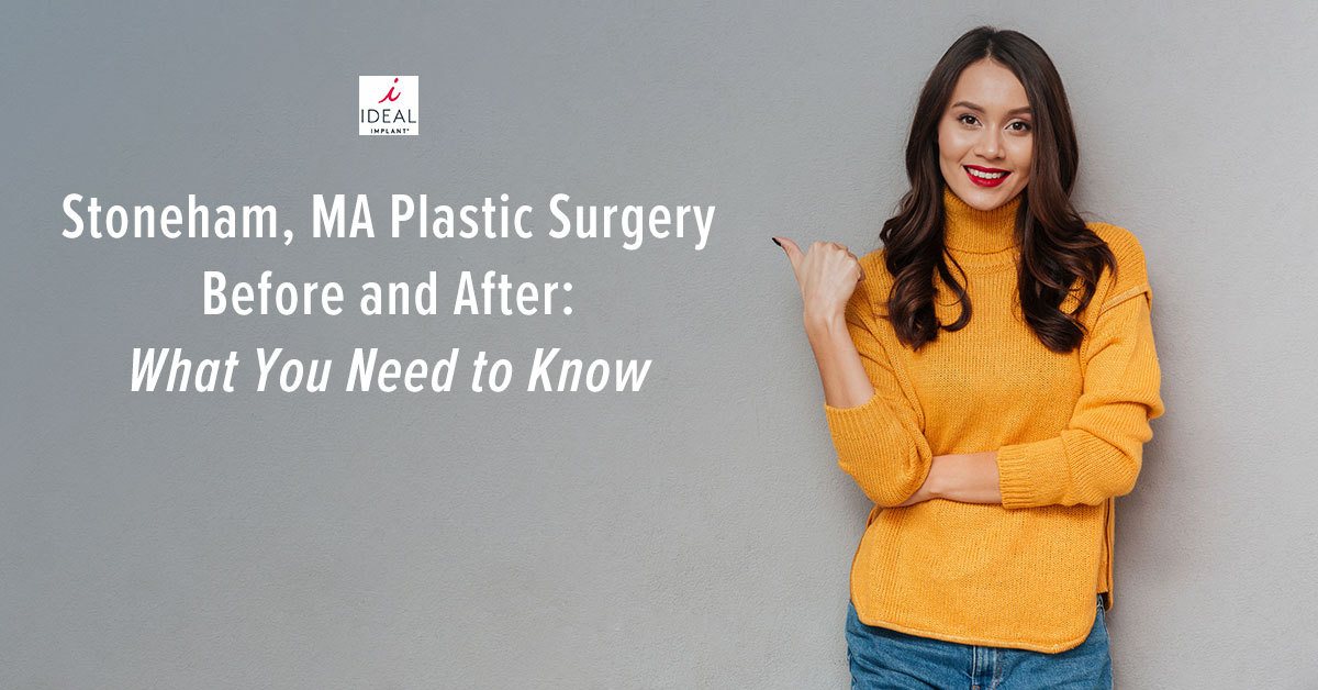 Stoneham, MA, Plastic Surgery Before and After: What You Need to Know