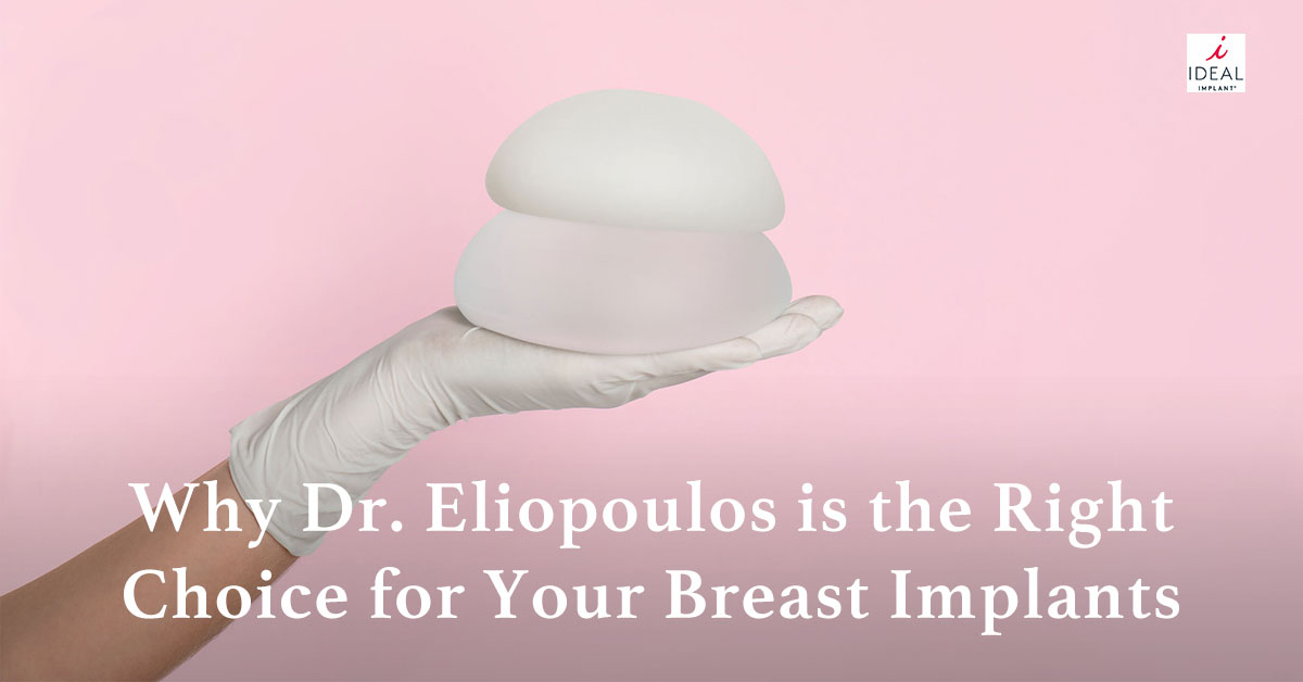 Why Dr. Eliopoulos is the Right Choice for Your Breast Implants
