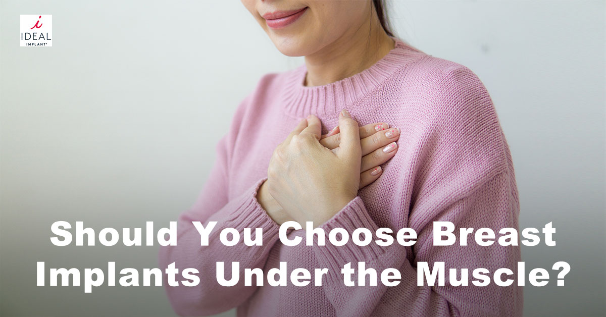 Should You Choose Breast Implants Under the Muscle?