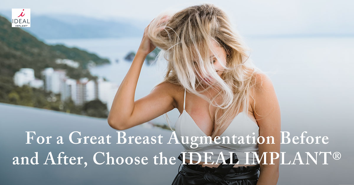 For a Great Breast Augmentation Before and After, Choose the IDEAL IMPLANT®