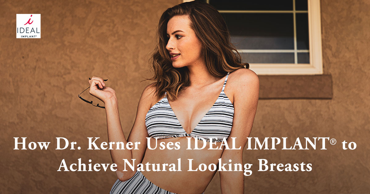 How Dr. Kerner Uses IDEAL IMPLANT to Achieve Natural Looking Breasts
